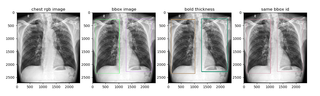 _images/chest_with_bbox.png