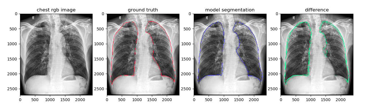 _images/chest_with_contours.png